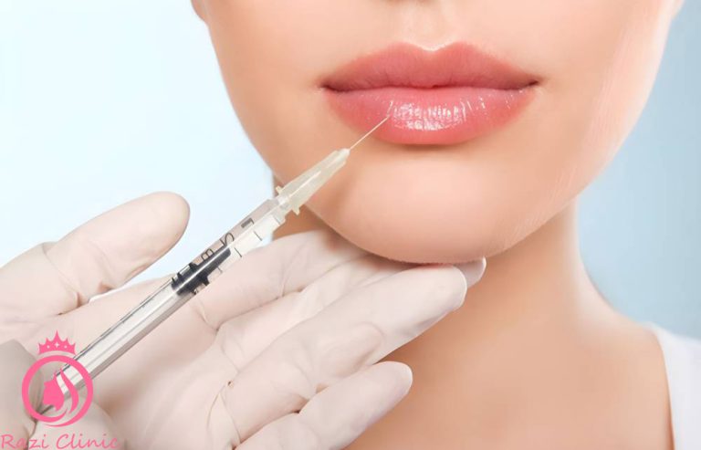 تزریق ژل لب برای فرم‌دهی لب