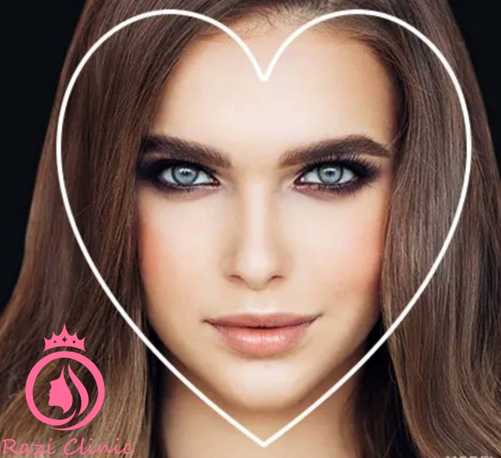 تزریق ژل گونه برای صورت قلبی