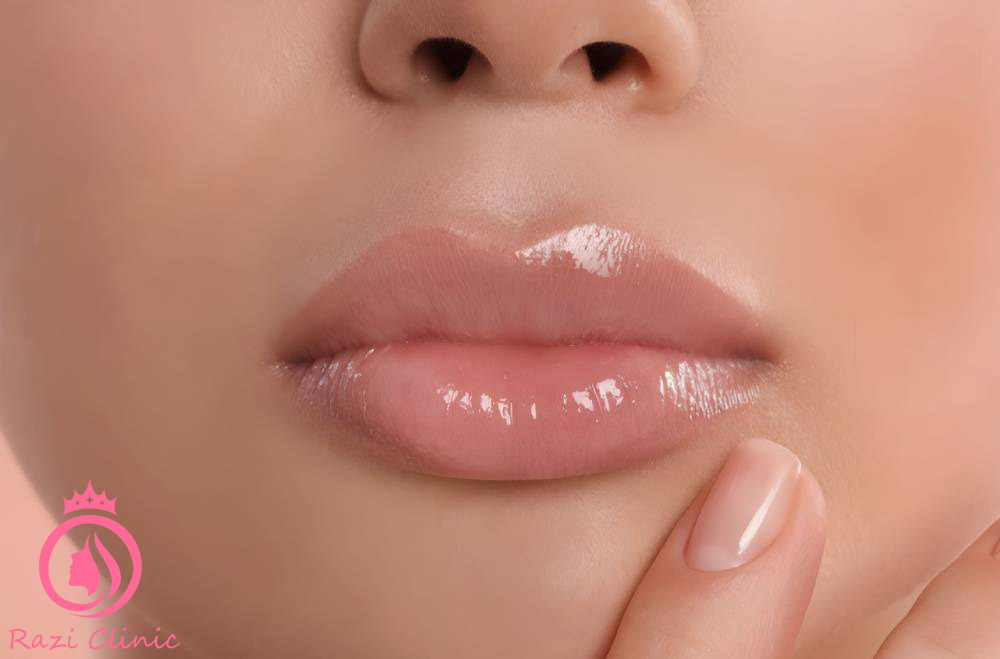 تزریق ژل لب مدل قلبی