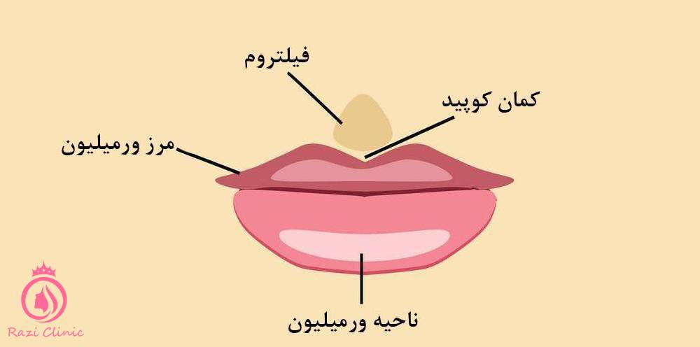 منظور از تزریق ژل لب به روش عروسکی چیست