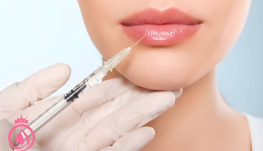 تزریق ژل لب برای فرم‌دهی لب