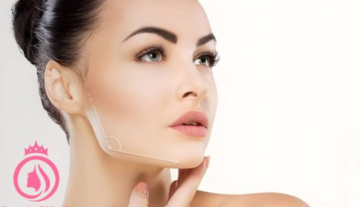بهترین روش‌ زاویه سازی صورت، فک و چانه